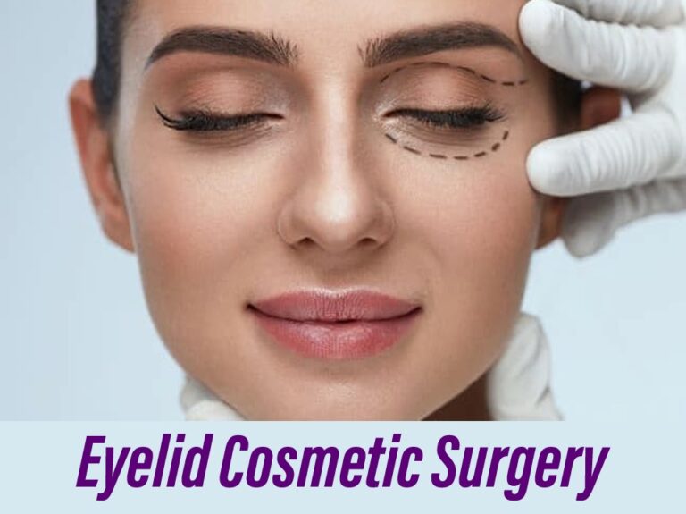 Eyelid Cosmetic Surgery