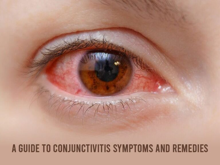 A Guide to Conjunctivitis Symptoms and Remedies